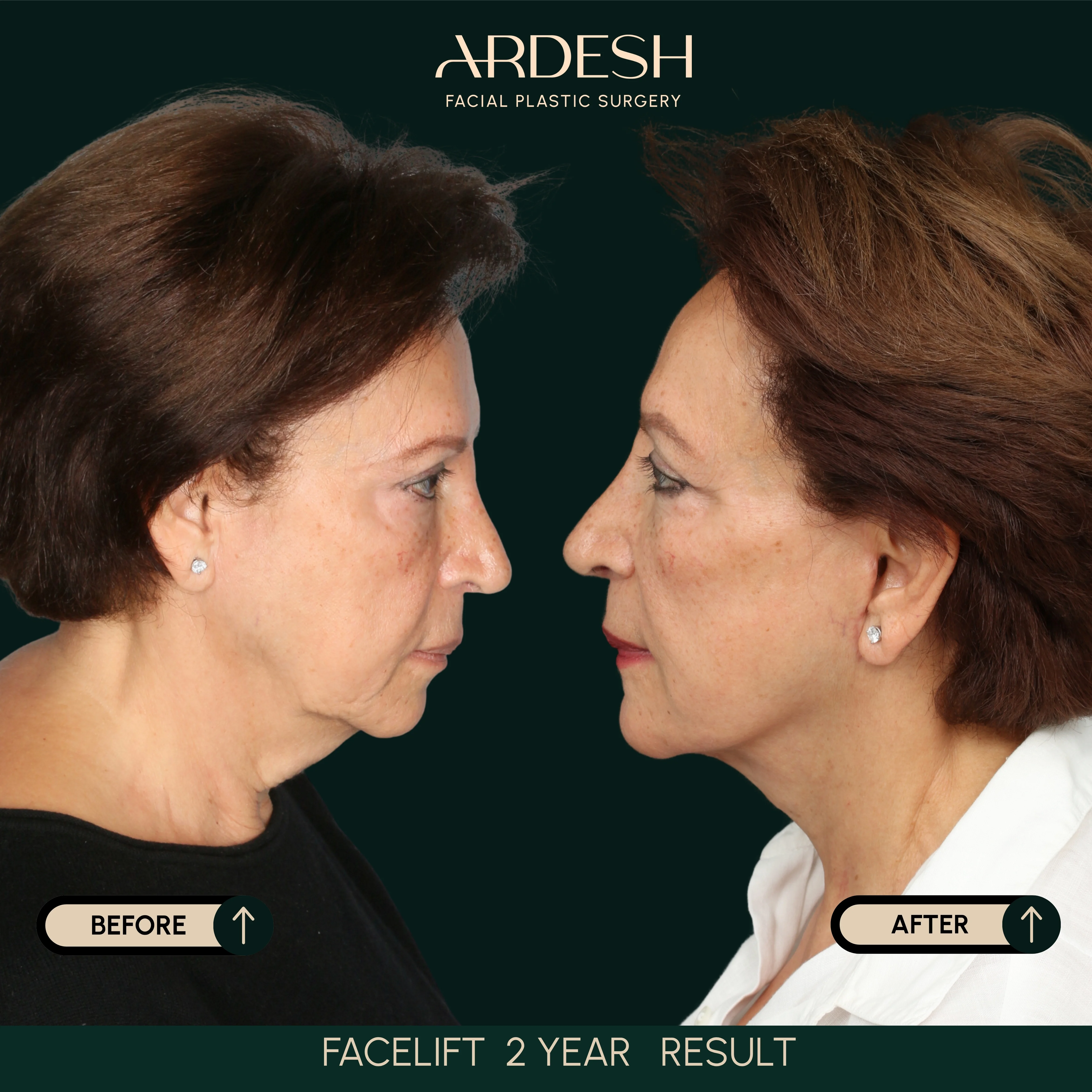 Patient transformation result 27