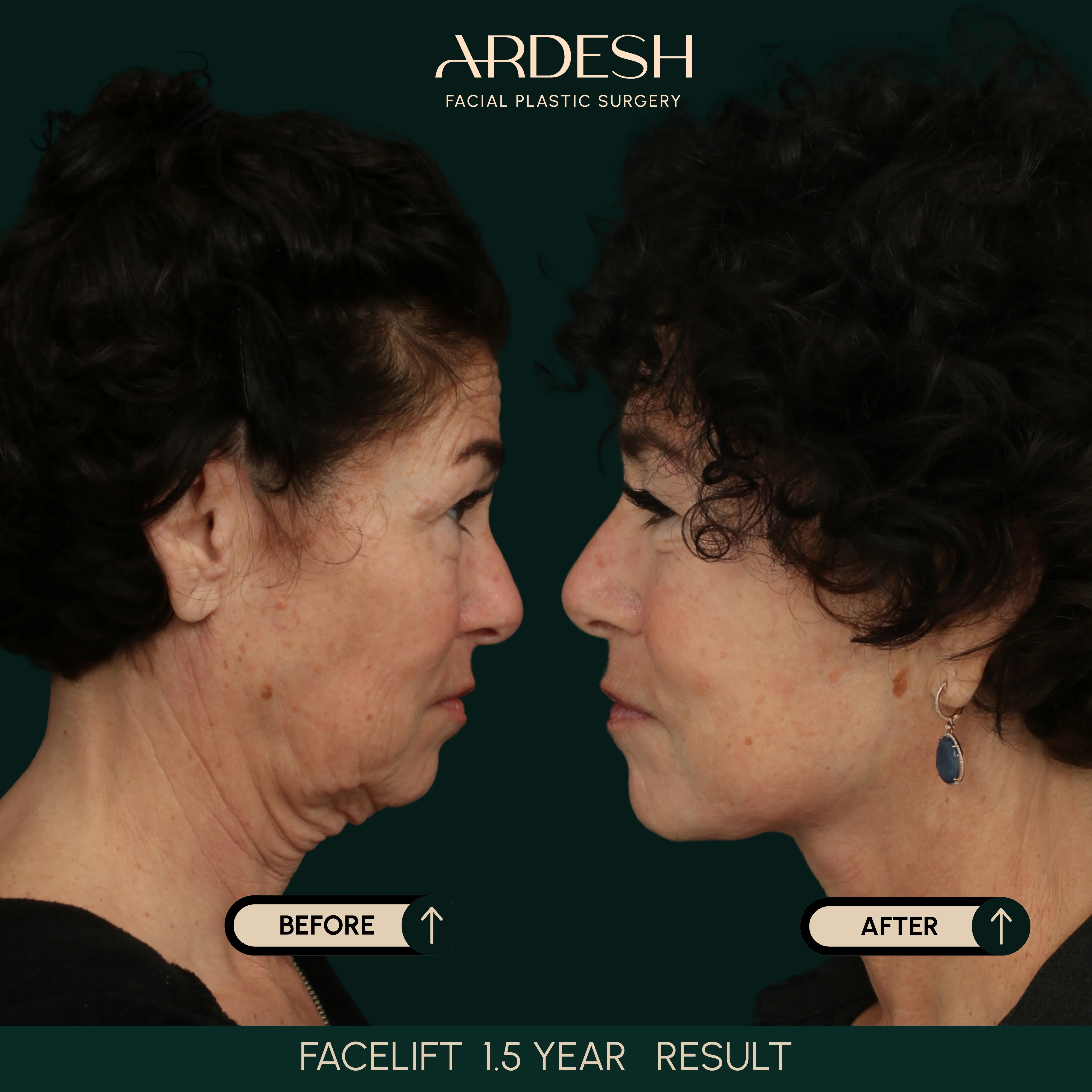 Patient transformation result 28