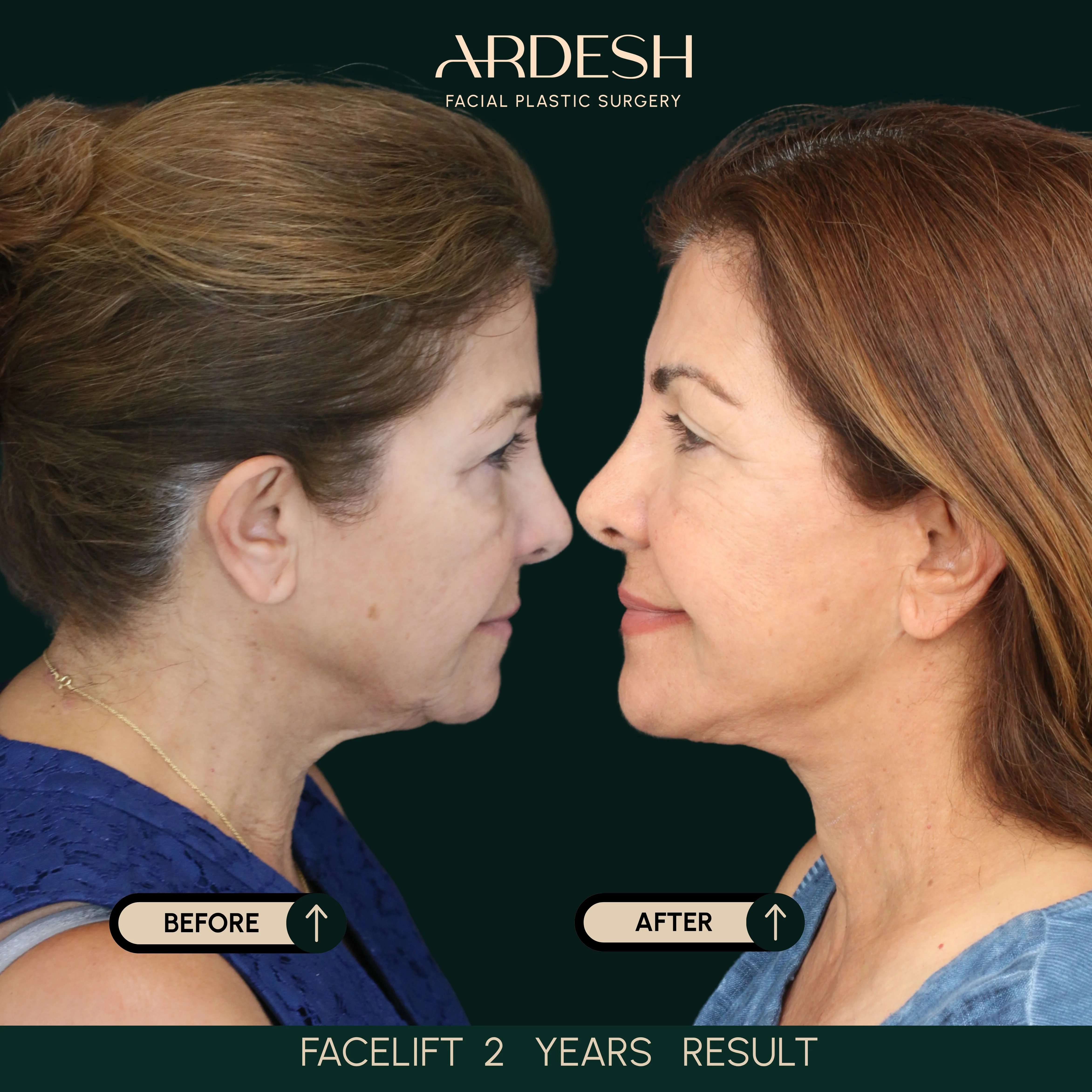 Patient transformation result 23