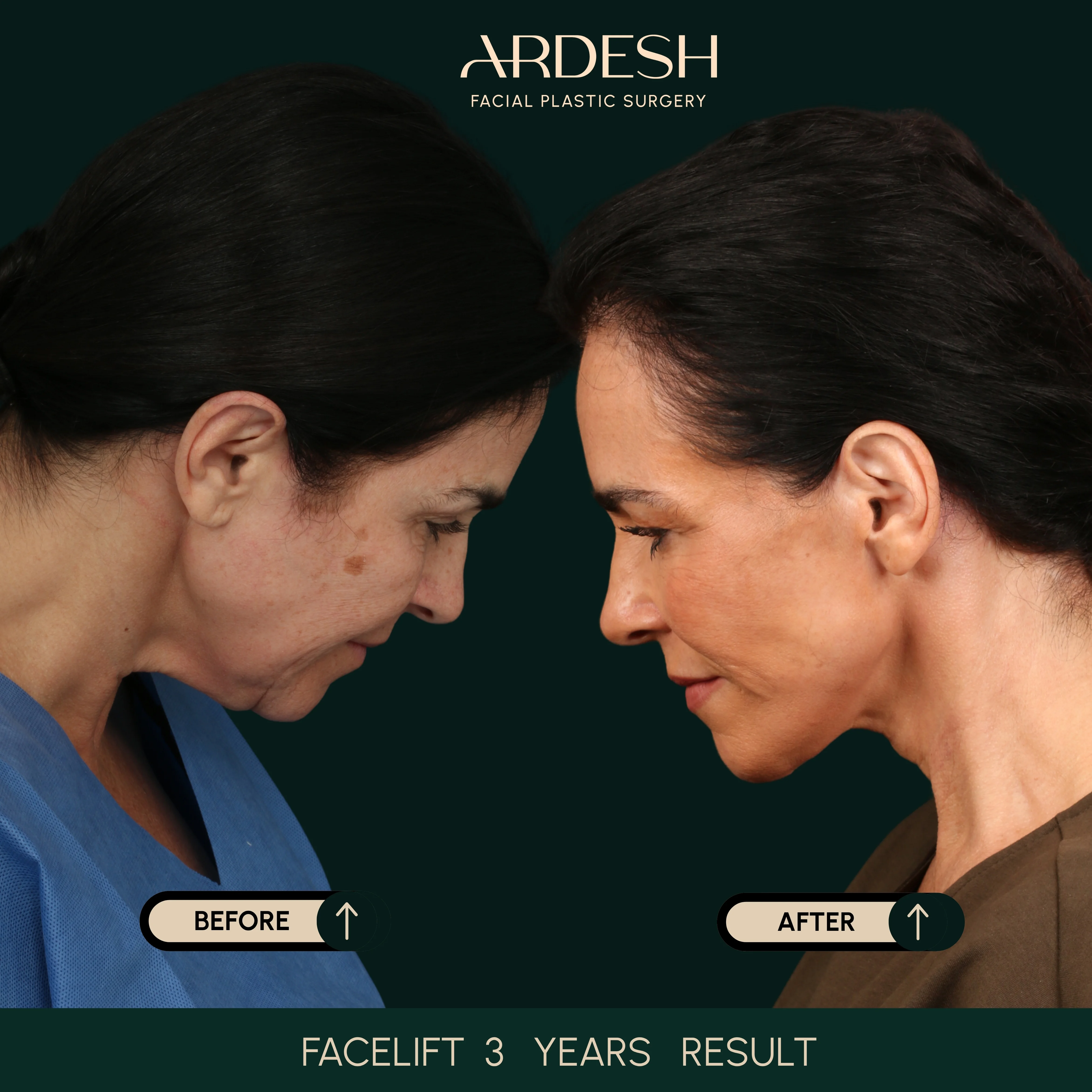 Patient transformation result 24
