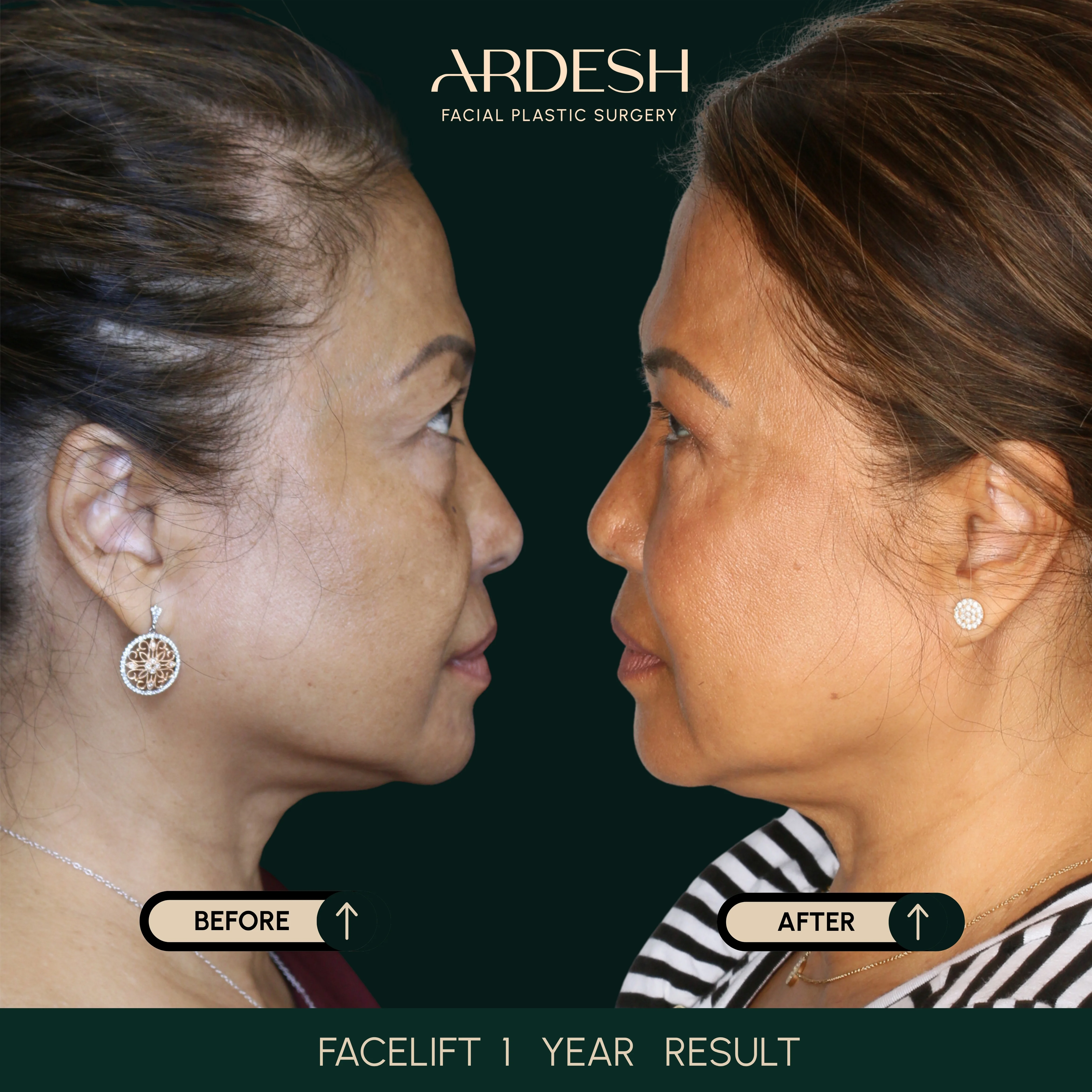 Patient transformation result 25