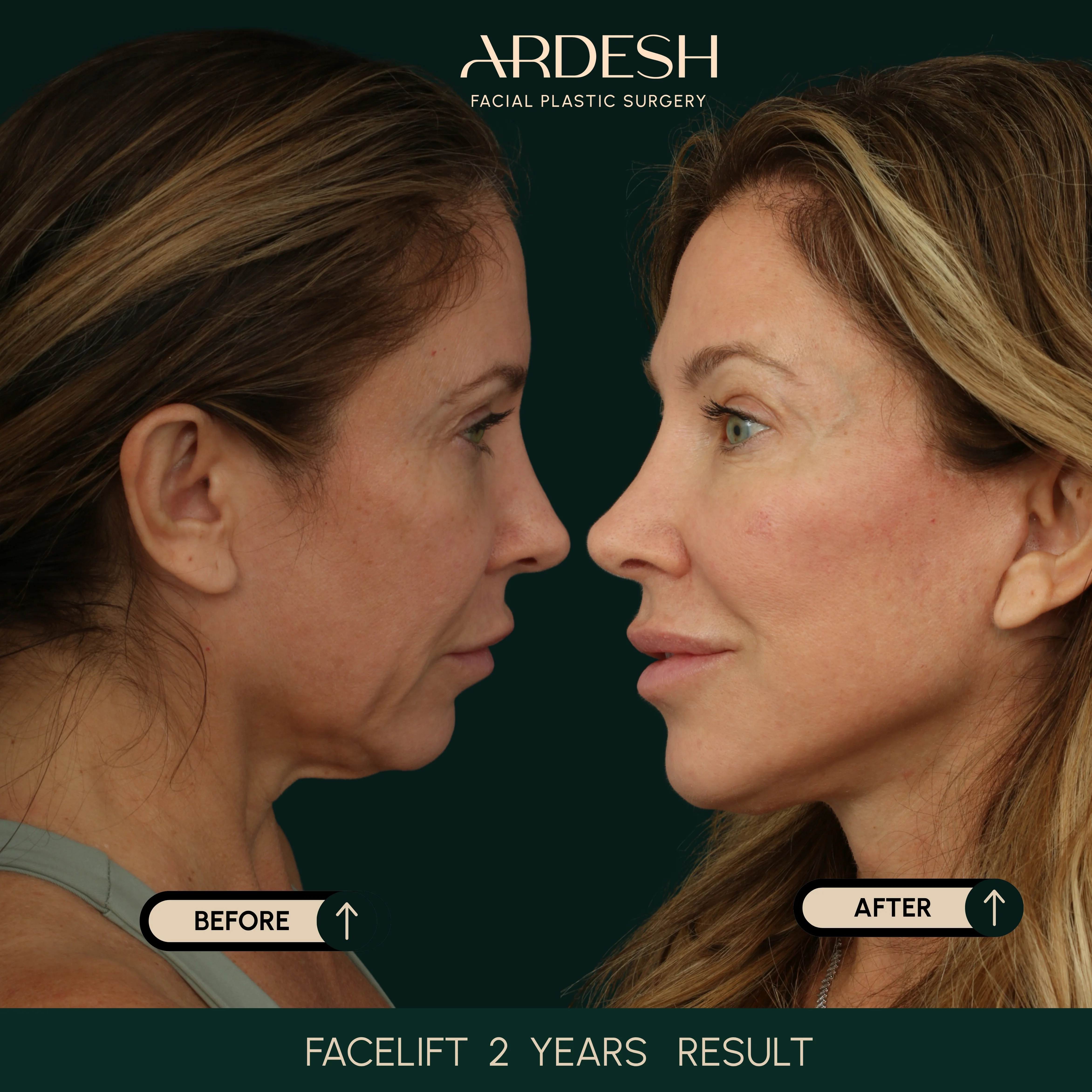 Patient transformation result 26