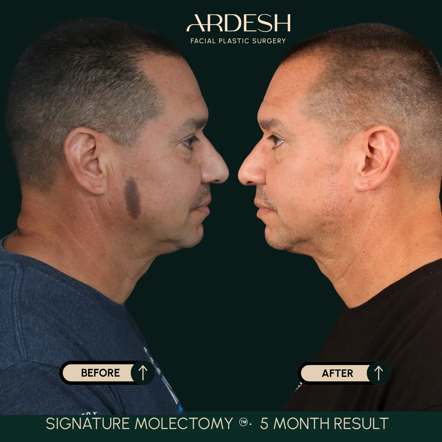 Patient transformation result 46
