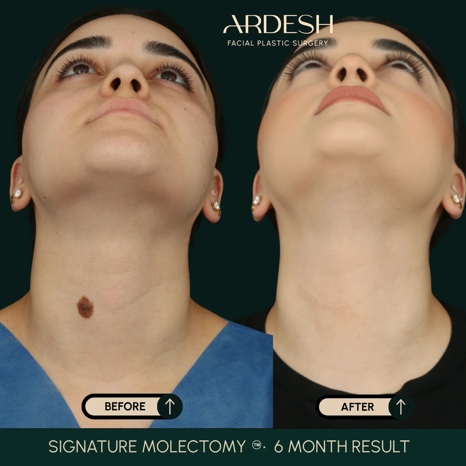 Patient transformation result 47