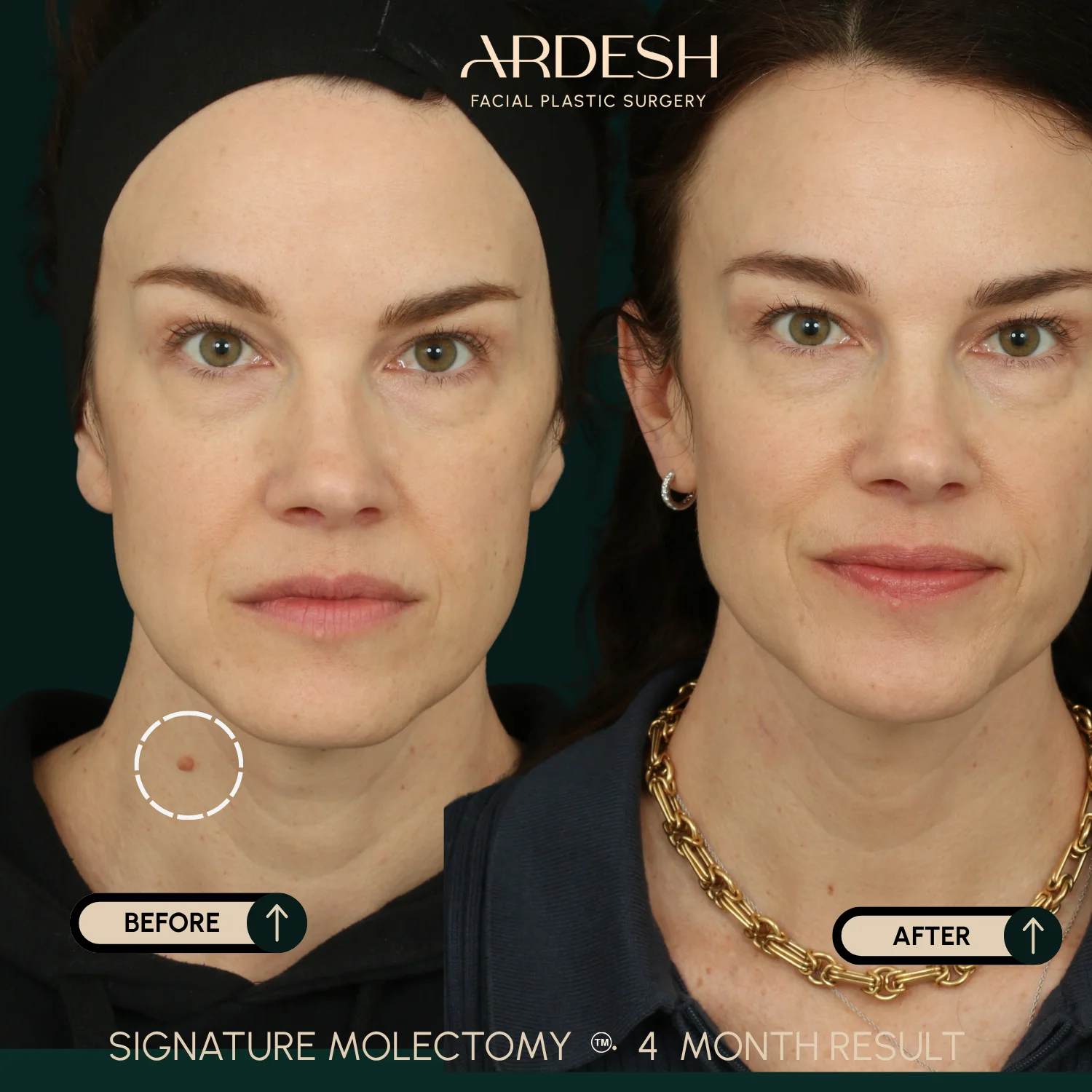 Patient transformation result 48
