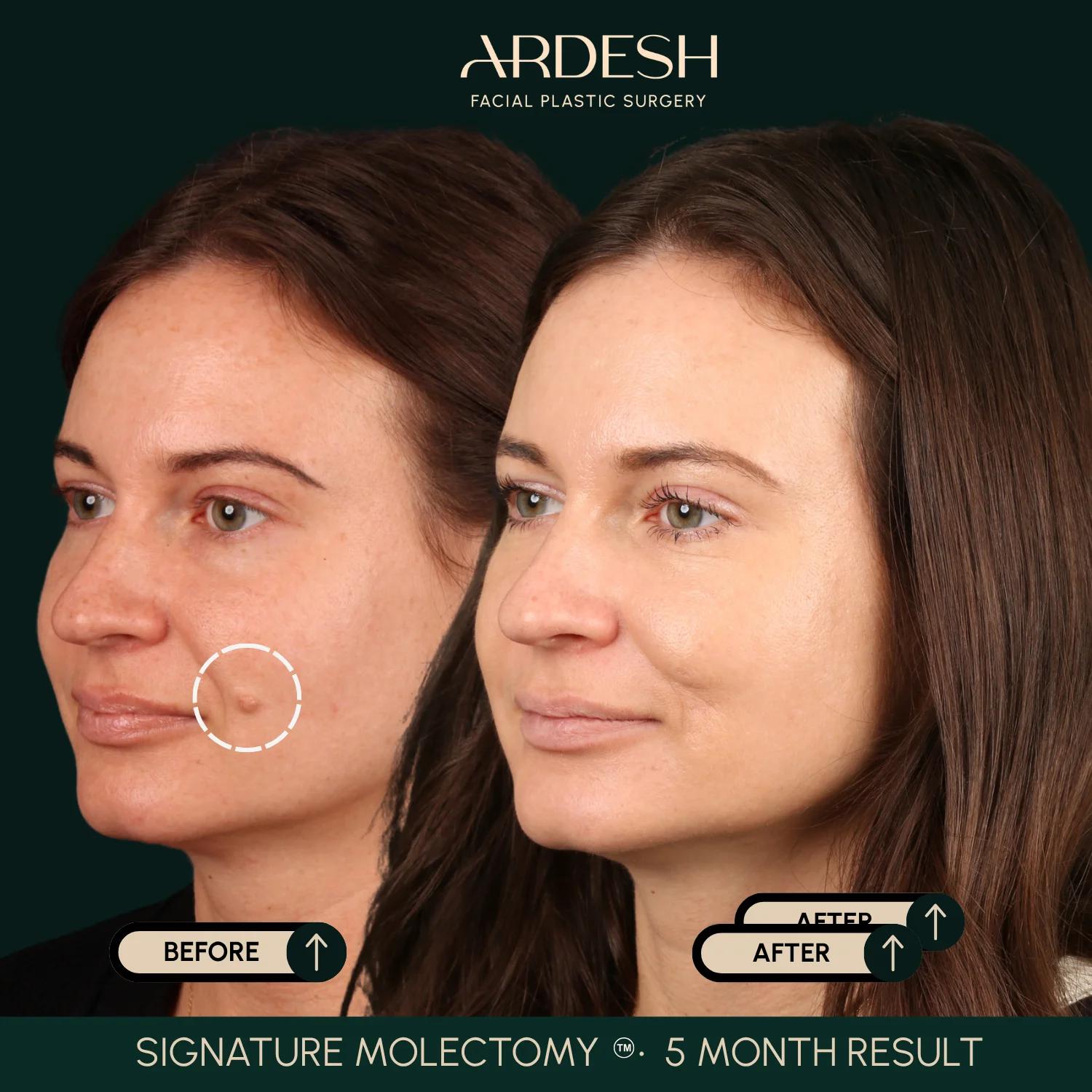 Patient transformation result 49
