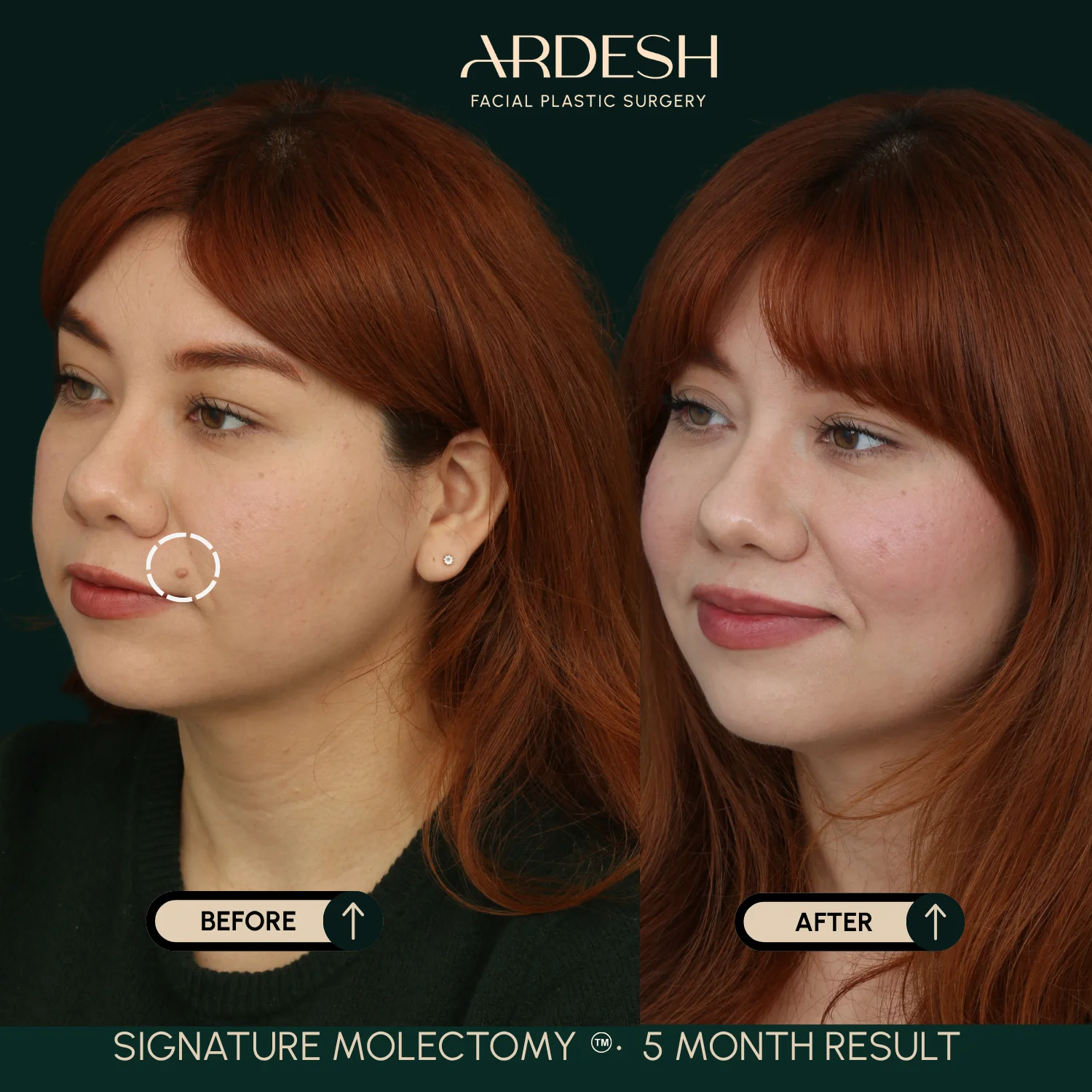 Patient transformation result 50