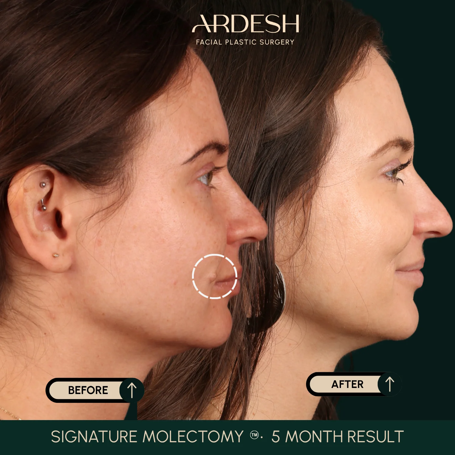 Patient transformation result 51