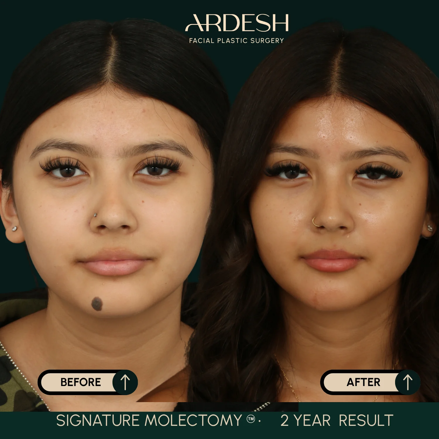 Patient transformation result 52