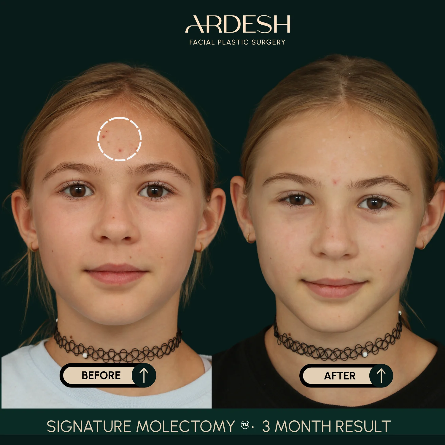 Patient transformation result 53