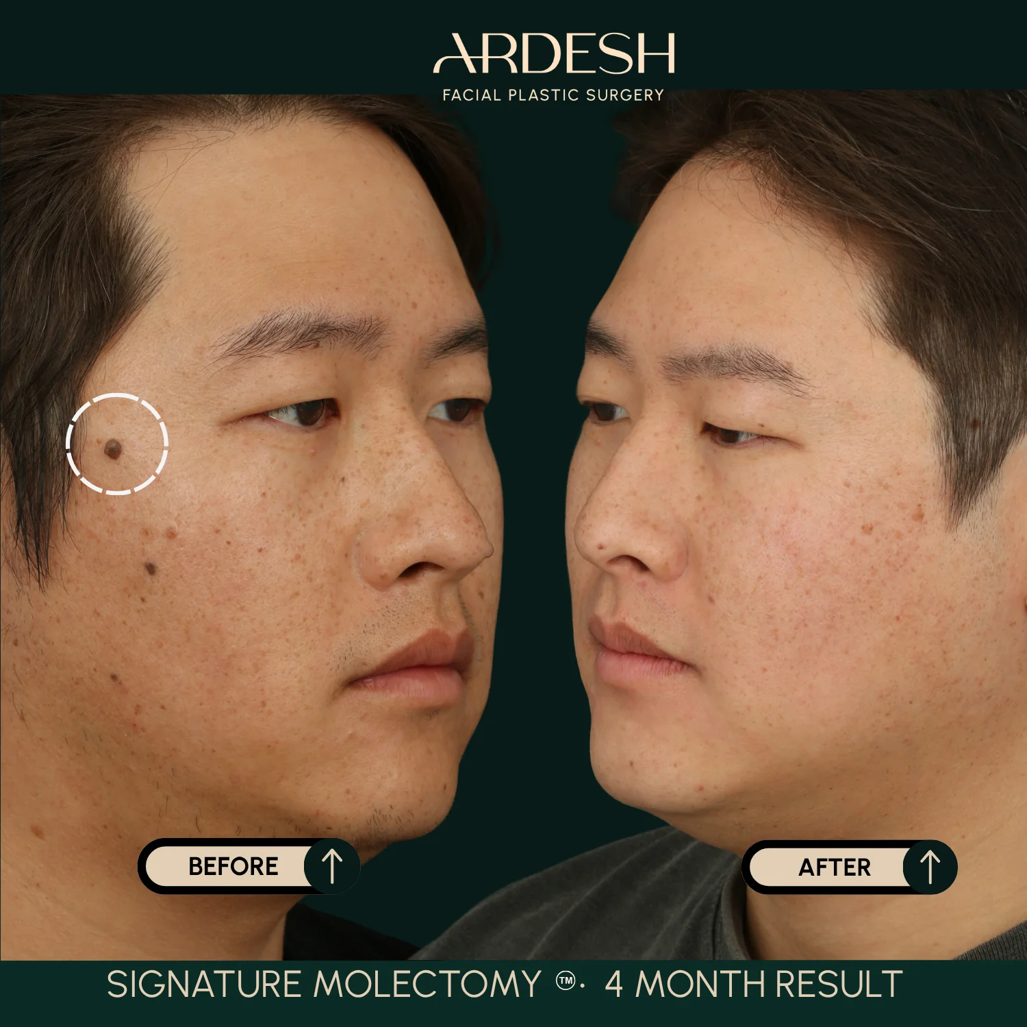Patient transformation result 54
