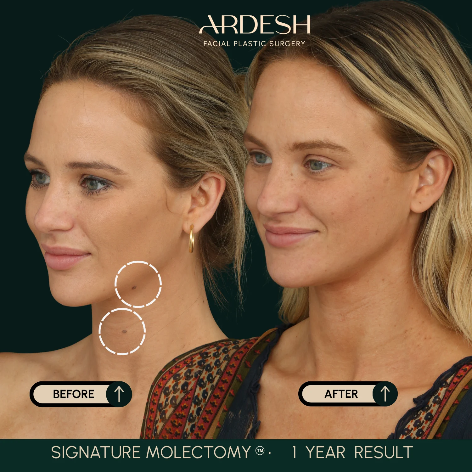 Patient transformation result 55