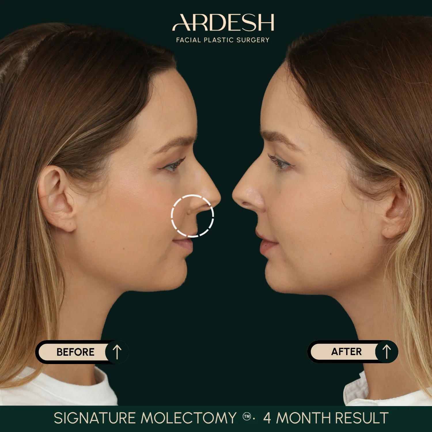 Patient transformation result 56