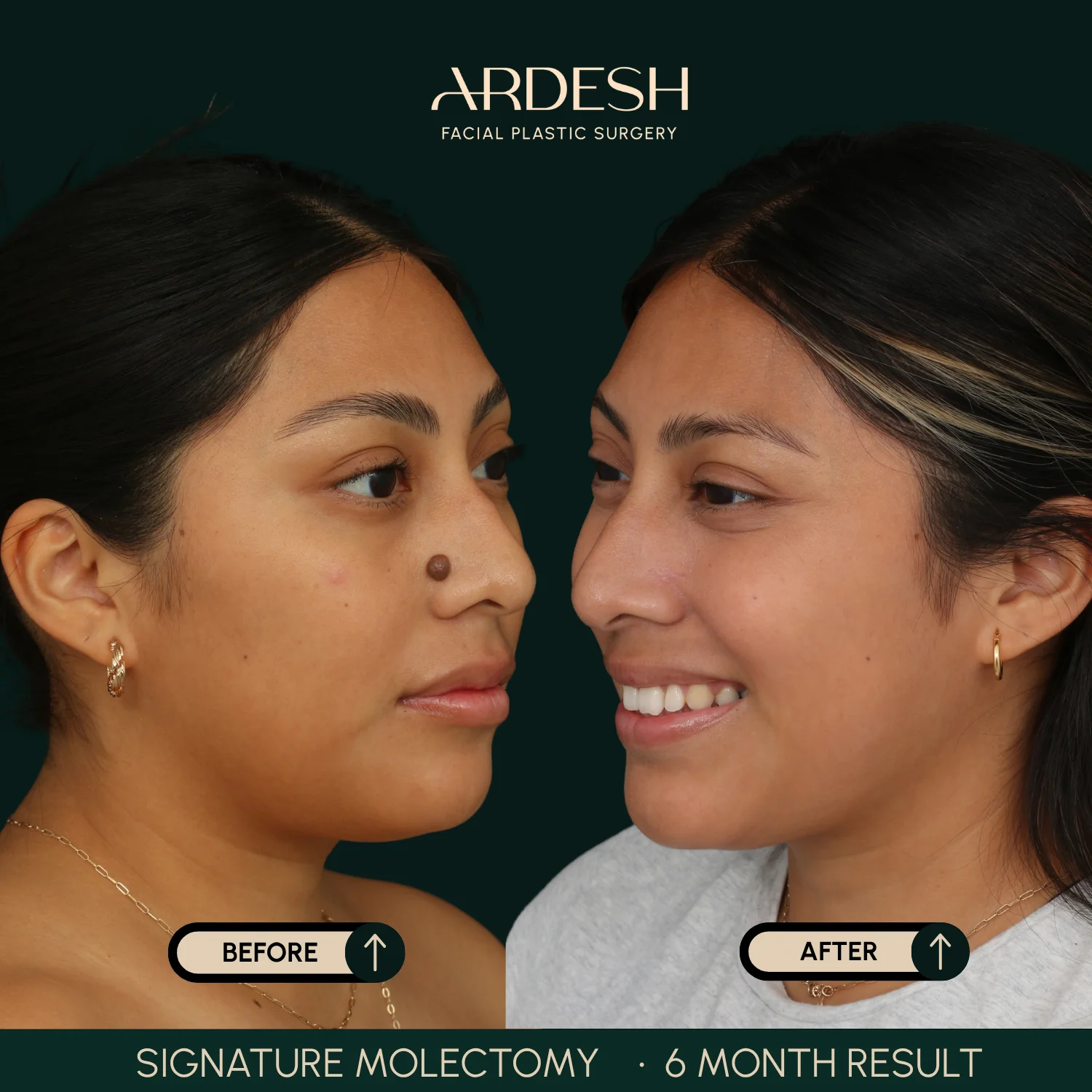 Patient transformation result 57