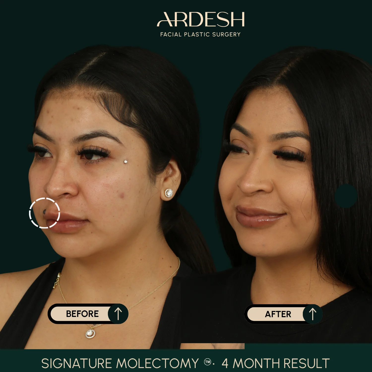 Patient transformation result 60