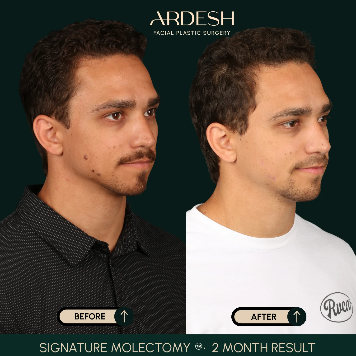Patient transformation result 61
