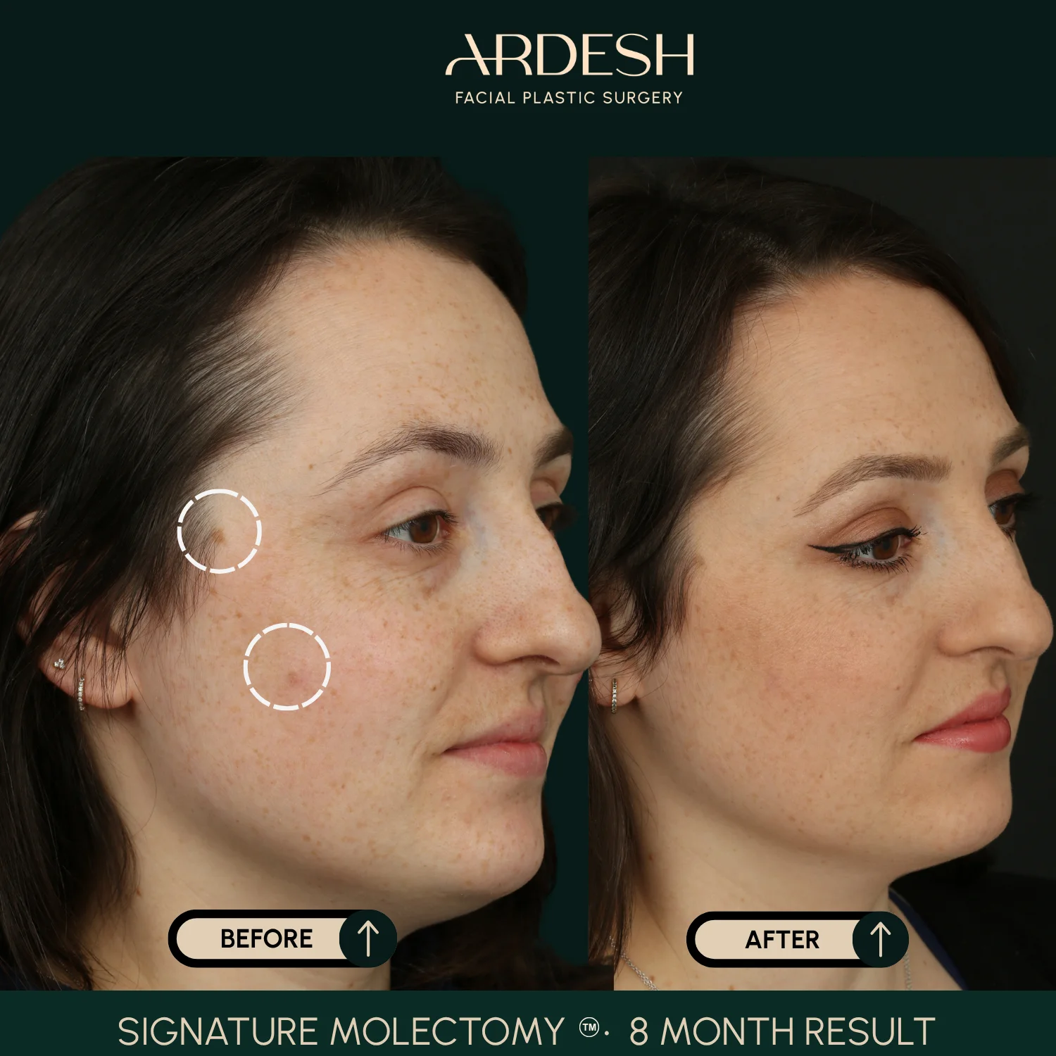 Patient transformation result 62