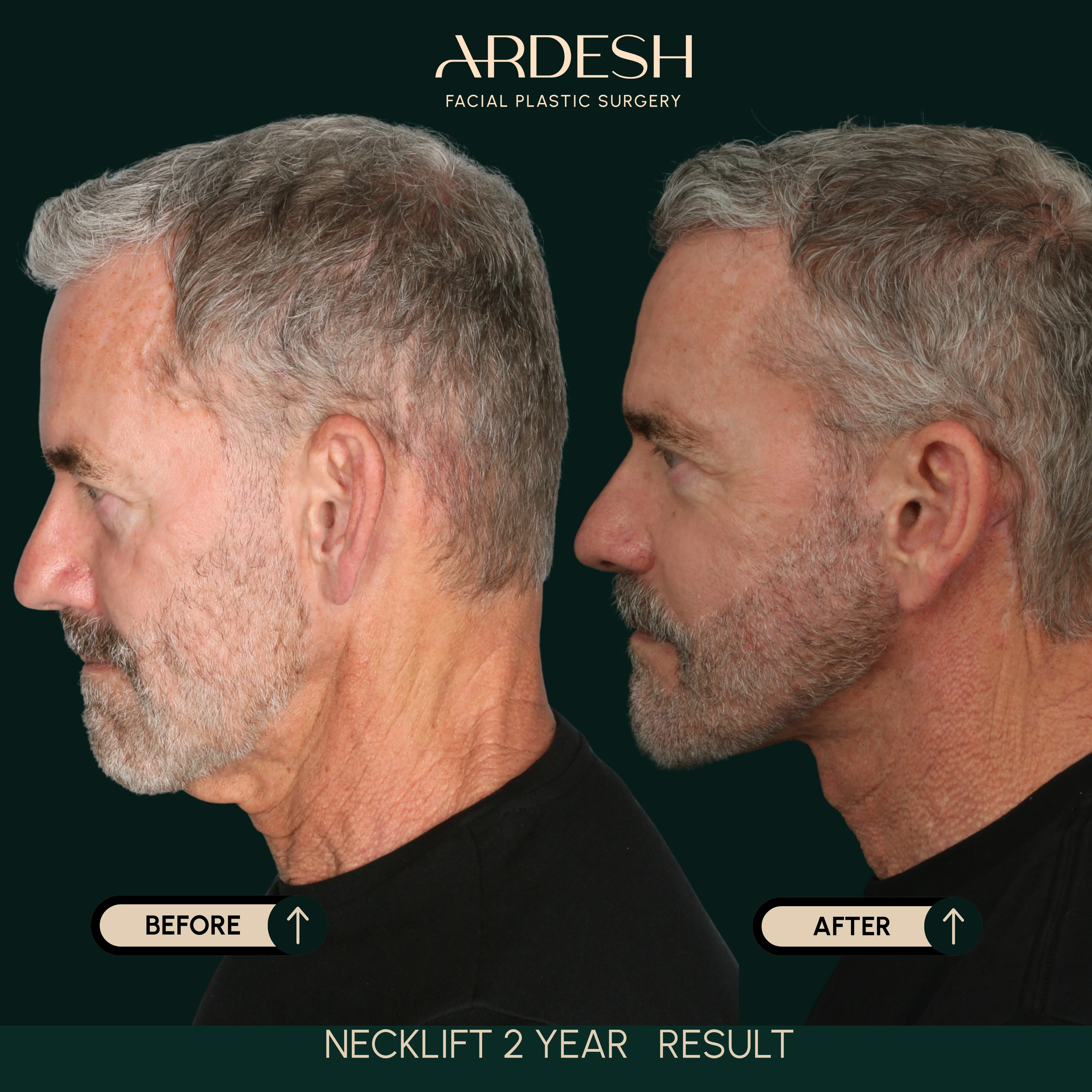 Patient transformation result 70
