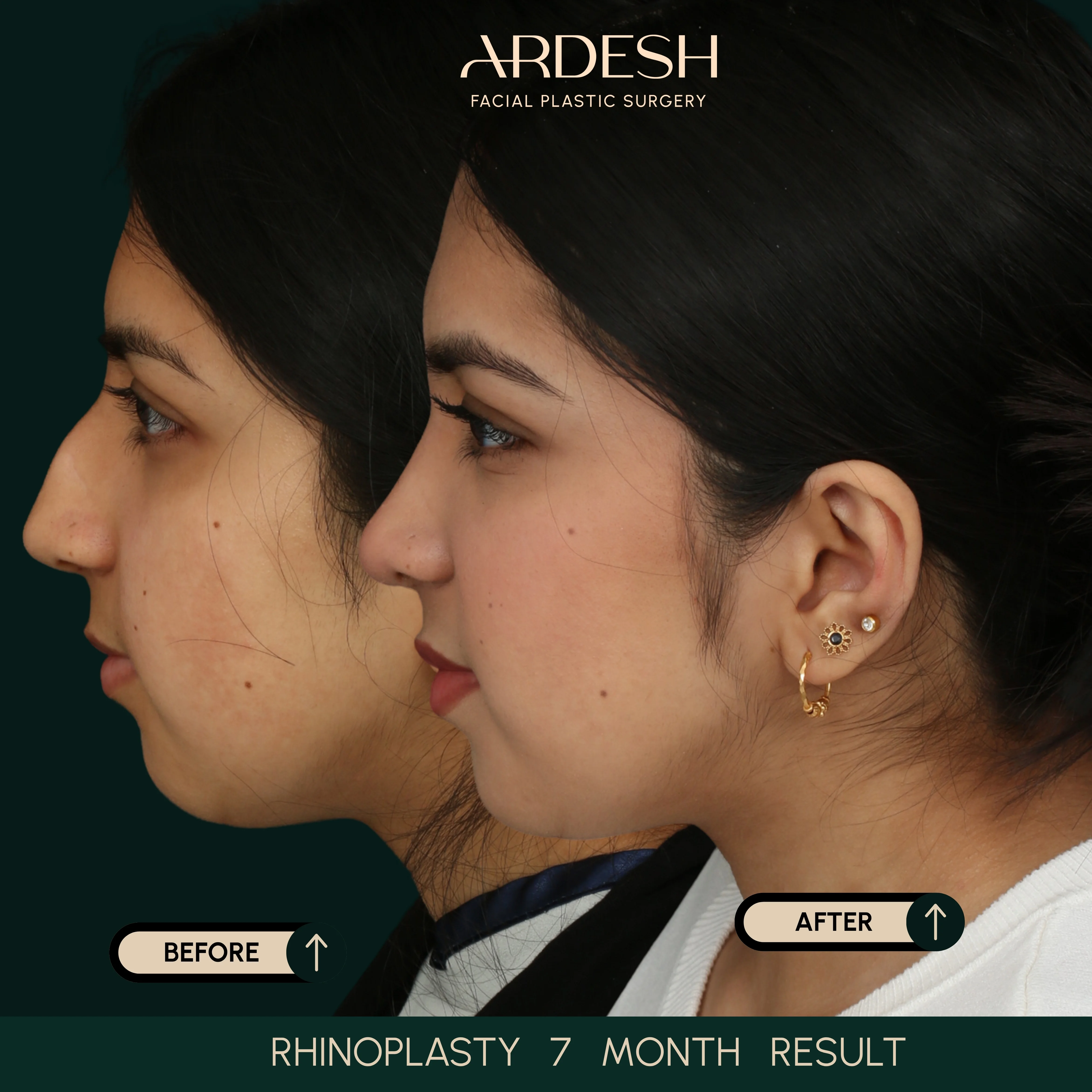 Patient transformation result 76